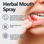 Herbal Mouth Spray, Refreshing Breath Repair Swollen Gums Relieve Oral Ulcer Yang Portable Spray